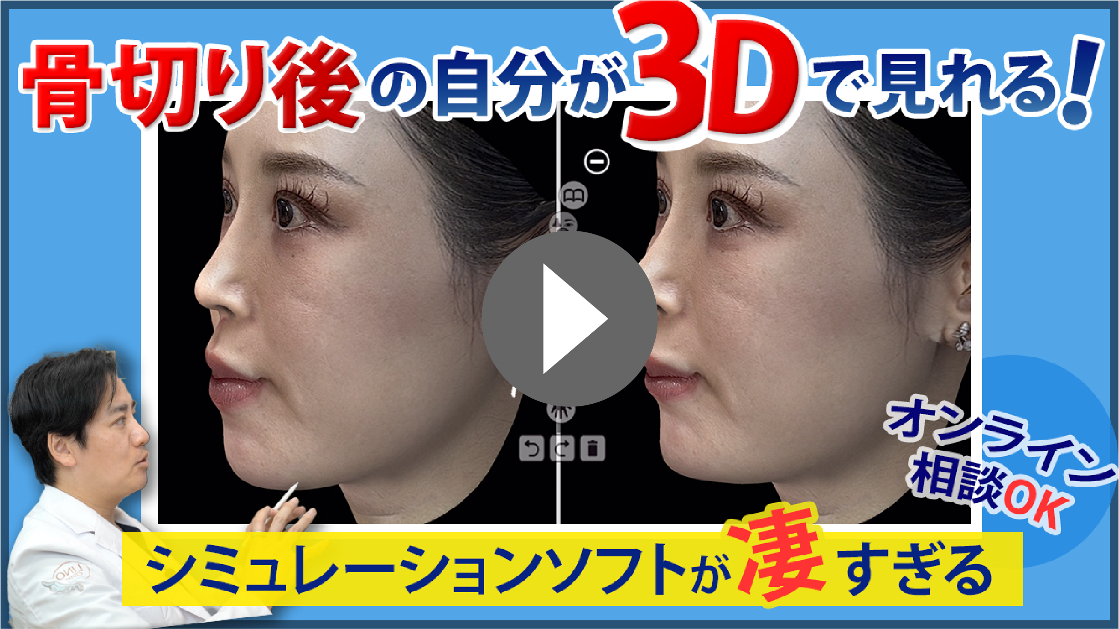 Crisalix(クリサリクス)の解説動画はこちら